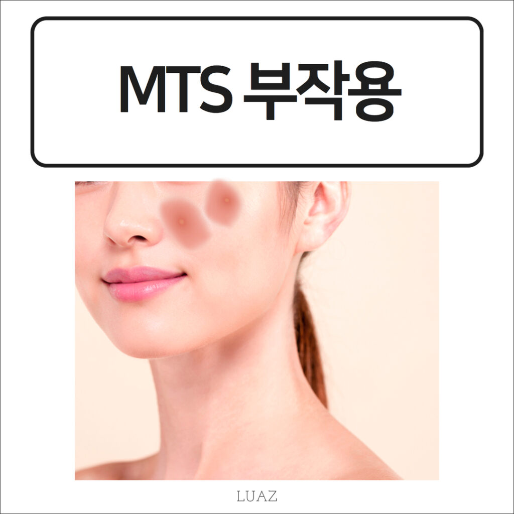 MTS 부작용